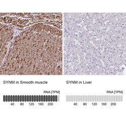 alpha Desmuslin Antibody, Novus Biologicals 25 &mu;L, Unlabeled:Antibodies,